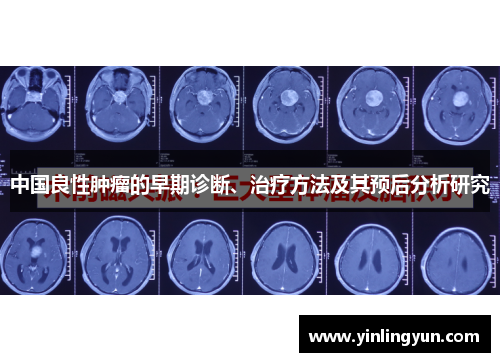 中国良性肿瘤的早期诊断、治疗方法及其预后分析研究