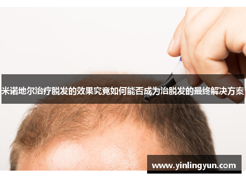 米诺地尔治疗脱发的效果究竟如何能否成为治脱发的最终解决方案